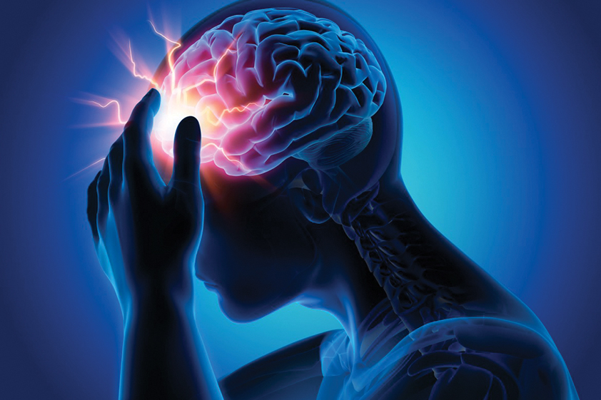 Stroke (Brain Attack) Treatment